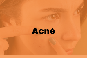 Acné