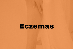 Eczemas